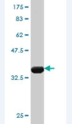 Western Blot: CHERP Antibody (1A5) [H00010523-M02]