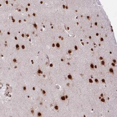 Immunohistochemistry-Paraffin: CHERP Antibody [NBP2-13837]