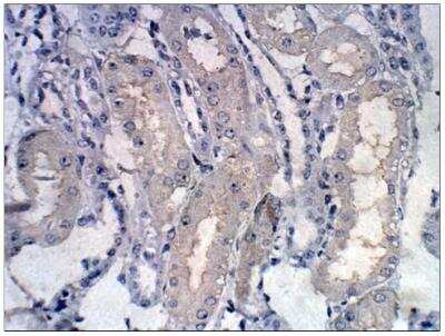 Immunohistochemistry-Paraffin: CHERP Antibody [NBP3-12209]