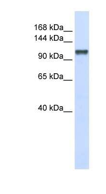 Western Blot: CHERP Antibody [NBP1-80457]