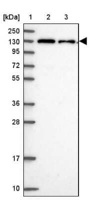 Western Blot: CHERP Antibody [NBP2-13837]