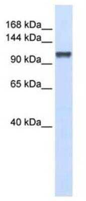 Western Blot: CHERP Antibody [NBP3-12209]