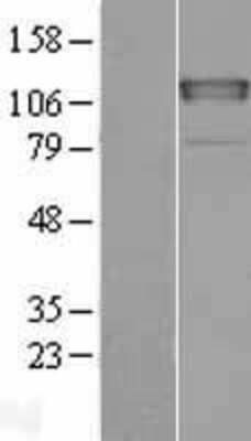 Western Blot: CHERP Overexpression Lysate [NBL1-09148]