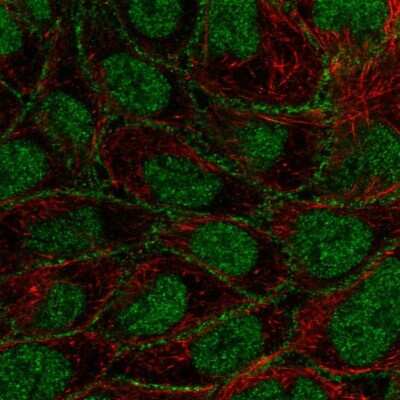 Immunocytochemistry/ Immunofluorescence: CHES1 Antibody [NBP2-38866]