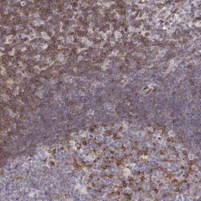 Immunohistochemistry-Paraffin: CHES1 Antibody [NBP2-38866]