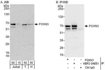 Immunoprecipitation: CHES1 Antibody [NBP2-04051]