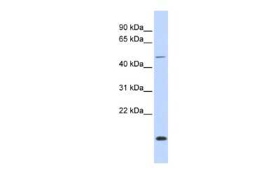 Western Blot: CHES1 Antibody [NBP2-84672]