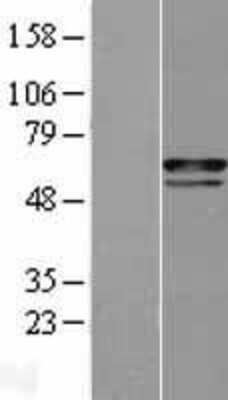 Western Blot: CHES1 Overexpression Lysate [NBL1-10812]