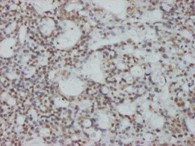 Immunohistochemistry-Paraffin: CHFR Antibody (1H3-A12) [H00055743-M01]