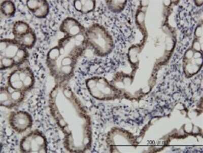 Immunohistochemistry-Paraffin: CHFR Antibody (1H3-A12) [H00055743-M01]