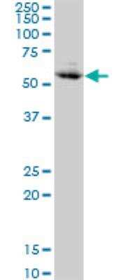 Western Blot: CHFR Antibody (1H3-A12) [H00055743-M01]