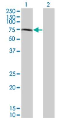 Western Blot: CHFR Antibody (2B11) [H00055743-M08]