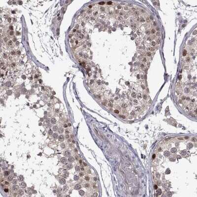 Immunohistochemistry: CHFR Antibody [NBP2-68970]