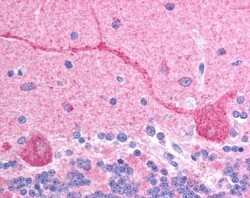 Immunohistochemistry-Paraffin: CHFR Antibody [NB100-1166]