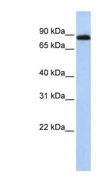 Western Blot: CHFR Antibody [NBP1-52955]