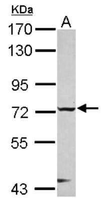 Western Blot: CHFR Antibody [NBP2-15878]