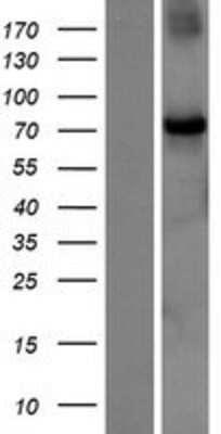 Western Blot: CHFR Overexpression Lysate [NBP2-10156]