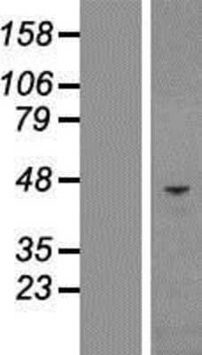 Western Blot: Chitinase 3-like 1/YKL-40 Overexpression Lysate [NBP2-08222]