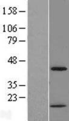 Western Blot: Chitinase 3-like 2 Overexpression Lysate [NBL1-09152]