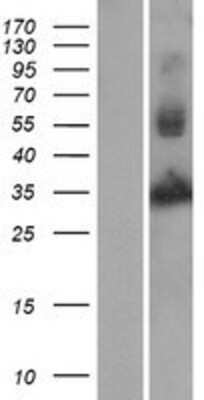 Western Blot: Chitinase 3-like 2 Overexpression Lysate [NBP2-04187]