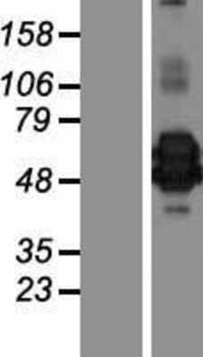 Western Blot: Chitinase 3-like 2 Overexpression Lysate [NBP2-08651]