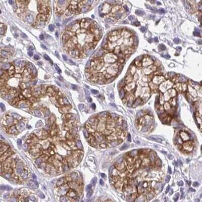 Immunohistochemistry: AMCase/CHIA Antibody [NBP2-32440]