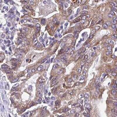 Immunohistochemistry: AMCase/CHIA Antibody [NBP2-32440]