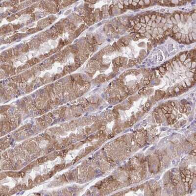 Immunohistochemistry: AMCase/CHIA Antibody [NBP2-32440]