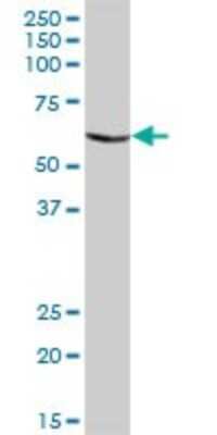 Western Blot: AMCase/CHIA Antibody [H00027159-B01P]