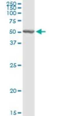 Western Blot: AMCase/CHIA Antibody [H00027159-D01P]