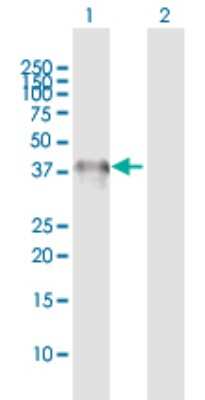 Western Blot: AMCase/CHIA Antibody [H00027159-D01P]