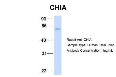 Western Blot: AMCase/CHIA Antibody [NBP1-58987]