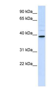 Western Blot: AMCase/CHIA Antibody [NBP1-58988]