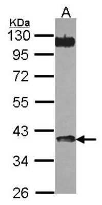 Western Blot: AMCase/CHIA Antibody [NBP2-15880]