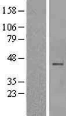 Western Blot: AMCase/CHIA Overexpression Lysate [NBL1-09153]