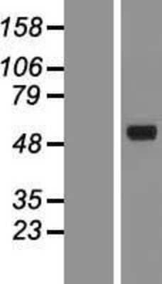 Western Blot: AMCase/CHIA Overexpression Lysate [NBP2-04604]