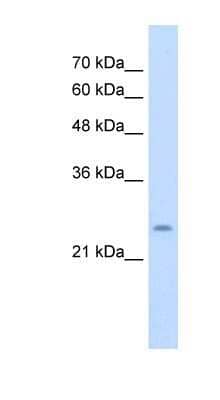 Western Blot: CHIC1 Antibody [NBP1-91589]