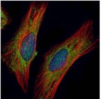 Immunocytochemistry/ Immunofluorescence: CHIC2 Antibody [NBP1-32719]