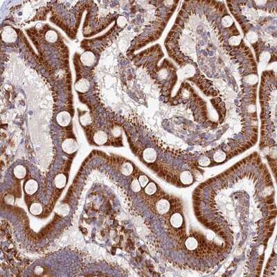 Immunohistochemistry-Paraffin: CHID1 Antibody [NBP1-81901]