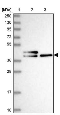 Western Blot: CHID1 Antibody [NBP1-81901]