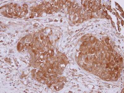 Immunohistochemistry-Paraffin: CHIP/STUB1 Antibody [NBP2-15882]