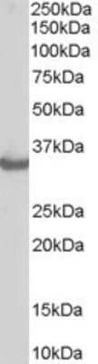 Western Blot: CHIP/STUB1 Antibody [NB300-982]