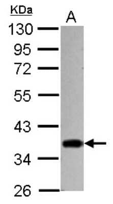 Western Blot: CHIP/STUB1 Antibody [NBP2-15882]