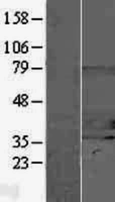 Western Blot: CHIP/STUB1 Overexpression Lysate [NBP2-07696]