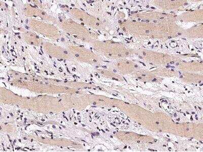 Immunohistochemistry-Paraffin: CHIP/STUB1 Antibody (006) [NBP2-90115]
