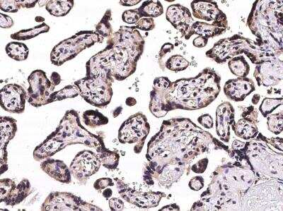 Immunohistochemistry-Paraffin: CHIP/STUB1 Antibody (006) [NBP2-90115]
