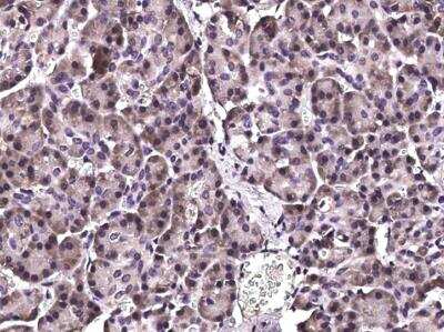 Immunohistochemistry-Paraffin: CHIP/STUB1 Antibody (006) [NBP2-90115]