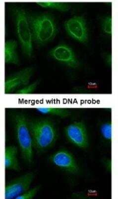 Immunocytochemistry/ Immunofluorescence: CHIP/STUB1 Antibody [NBP1-30936]