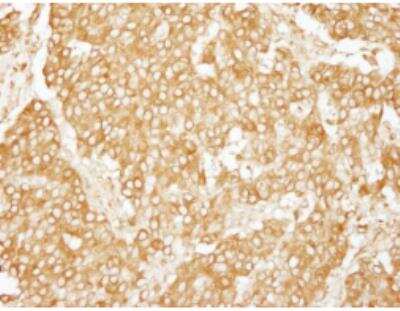 Immunohistochemistry-Paraffin: CHIP/STUB1 Antibody [NB100-77316]