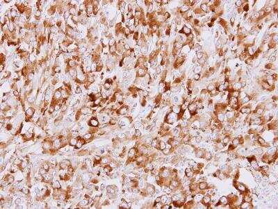 Immunohistochemistry-Paraffin: CHIP/STUB1 Antibody [NBP1-30936]